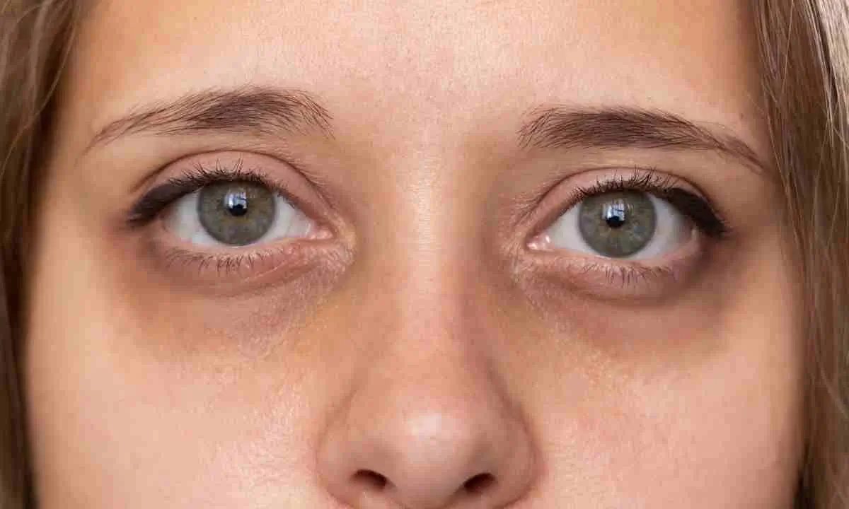 Skin Care Tips
