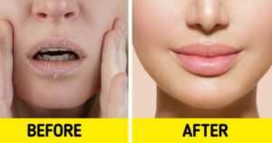 If You Want Soft Lips Like Cream, Then Do This Work Every Night