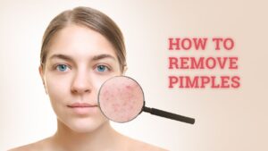 Pimple Remove Tips: Remove Any Type Of Pimple At Home By These Method