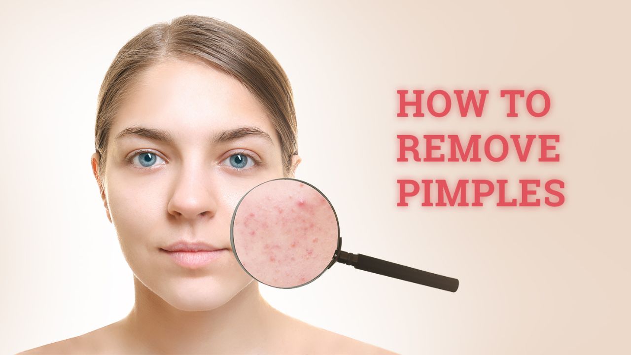 Pimple Remove Tips