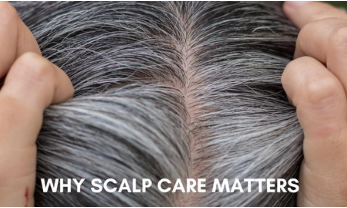 Scalp Care Tips 