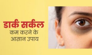 Dark Circles को करें जड़ से खत्म: चुकंदर और एलोवेरा जेल से बनाएं असरदार क्रीम, जानें उपयोग का सही तरीका