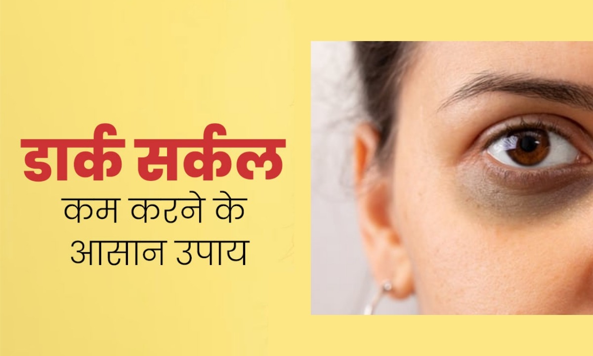 How To Remove Dark Circles