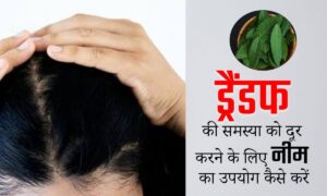 Hair Growth: डैंड्रफ से बालों के झड़ने तक, नीम पाउडर से करें बालों की हर समस्या का समाधान, जानें इस का सही इस्तेमाल