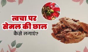 Skin Care: सेमल की छाल से मुंहासों की समस्या का इलाज करें, आयुर्वेद से जानें आसान तरीका