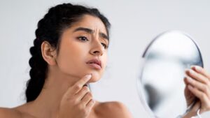 Remove Pimples Face: बिना किसी के मदद के घर बैठे ही ठीक करें, बड़े से बड़े पिंपल