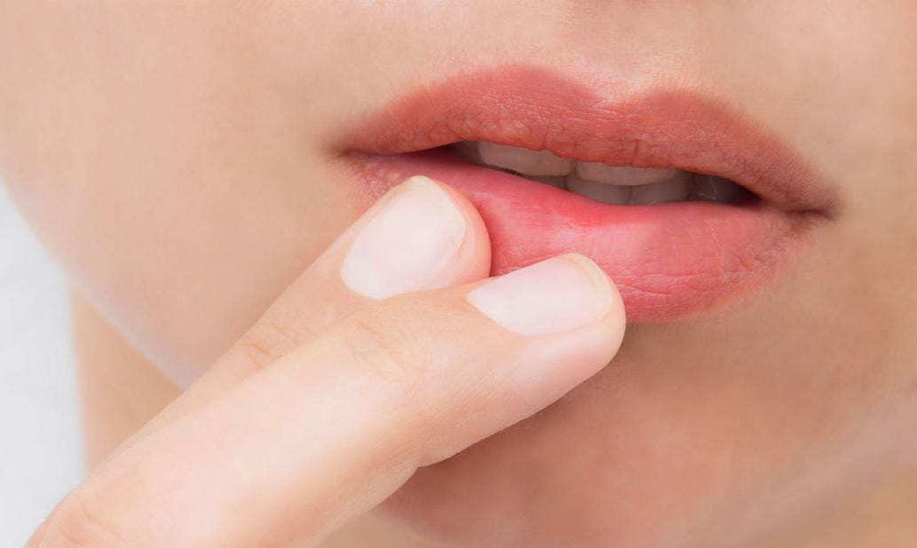 Soft Lips Tips