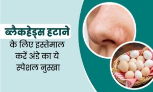 Skin Care: अंडे के इस नुस्खे से ब्लैकहेड्स को जल्दी हटाएं और पाएं एक बेदाग और चमकदार त्वचा