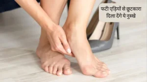 Skin Care: दही से पाएं फटी एड़ियों और रूखी त्वचा से तुरंत राहत, अपनाएं ये असरदार उपाय