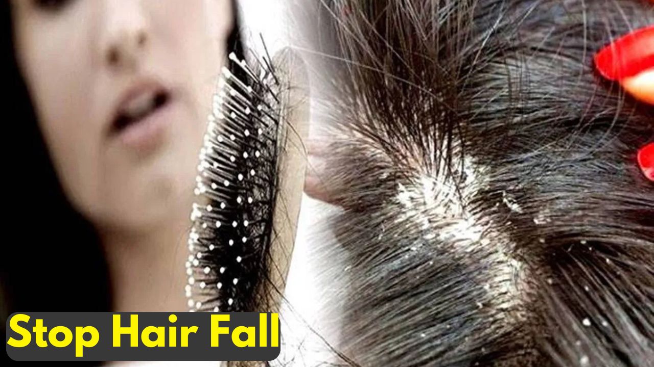 Hair Fall