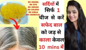 White Hair Treatment: कम उम्र में बाल सफेद क्यों होते हैं? जानिए कारण और उपाय