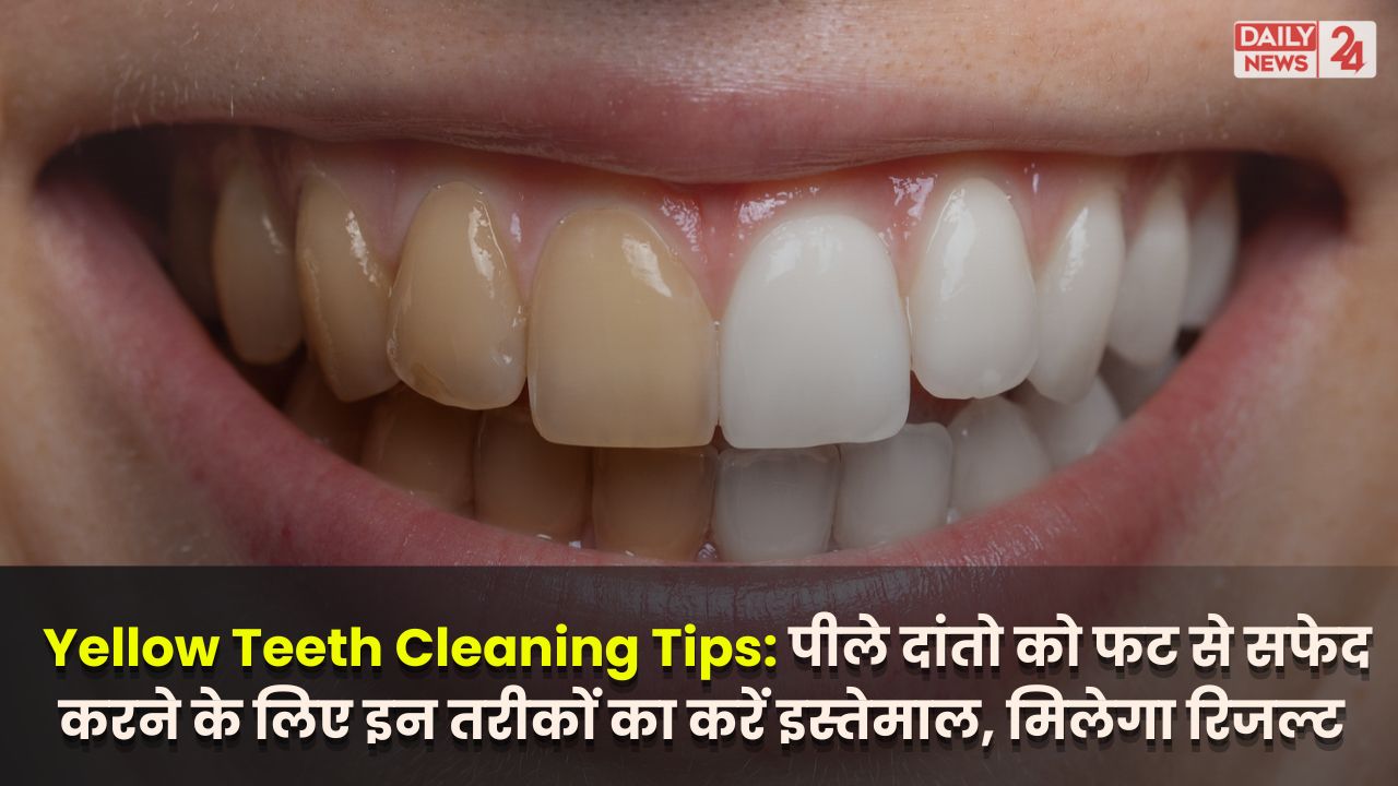 Yellow Teeth Cleaning Tips