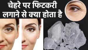 Skin Care: चेहरे के डार्क सर्कल्स से छुटकारा पाने के लिए जानें फिटकरी के उपयोग का आसान तरीका