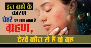 Skin Problems Astrology: जानें कैसे ग्रहों के दोष से प्रभावित होती है त्वचा, क्या है इसके उपाय?