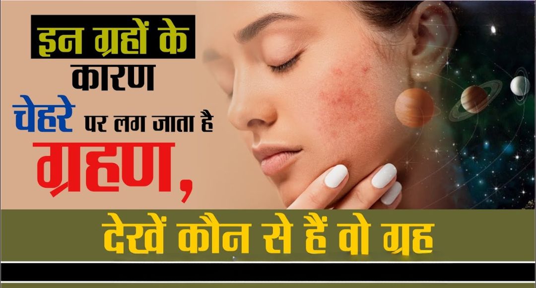 Skin Problems Astrology